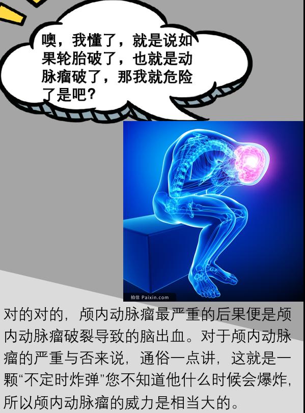 颅内动脉瘤属于主动脉瘤吗严重吗,脑动脉瘤和颅内动脉瘤是一回事吗
