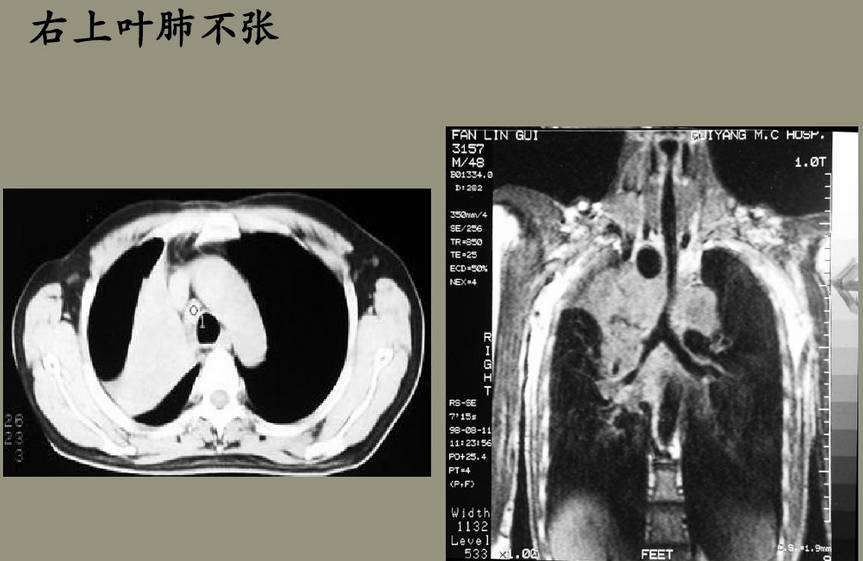 x线诊断边界模糊,x线诊断有误区吗