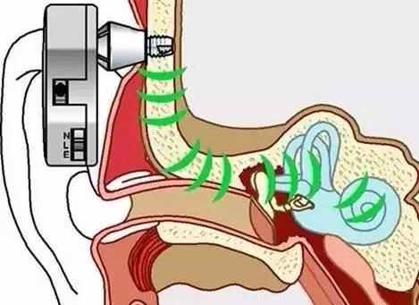 感冒会眩晕恶心吗,感冒眩晕天旋地转恶心