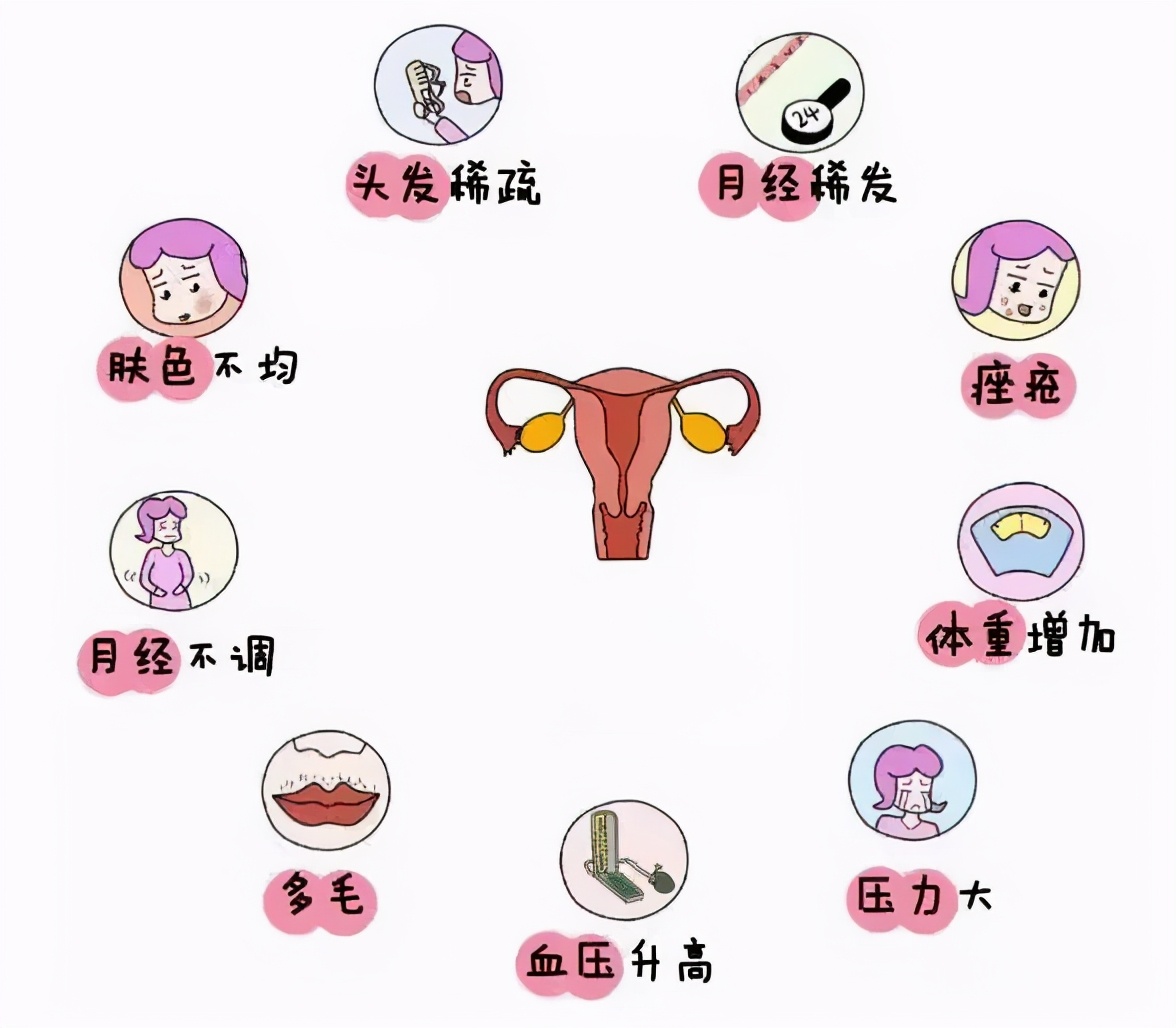 多囊例假正常也会不孕吗,多囊导致月经正常会自愈吗