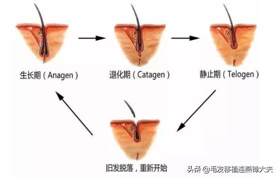 脱发2年,脱发一年了头发明显减少