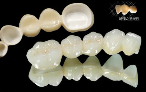 各类假牙价格,最便宜的假牙多少钱一颗