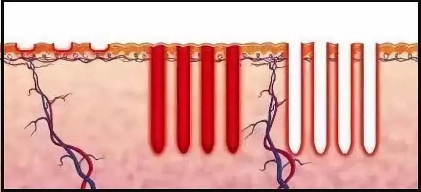 十年光学美容仪,初学者应该怎么选择美容仪