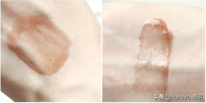 一瓶修丽可紫米告别双加干瘪、颧骨高耸、面部凹陷，重返少女肌