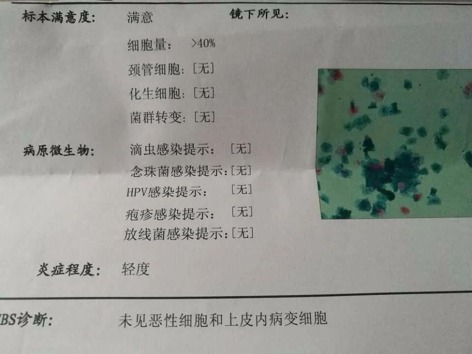 hpv疫苗接种注意事项及禁忌,月经期间可以接种hpv疫苗吗