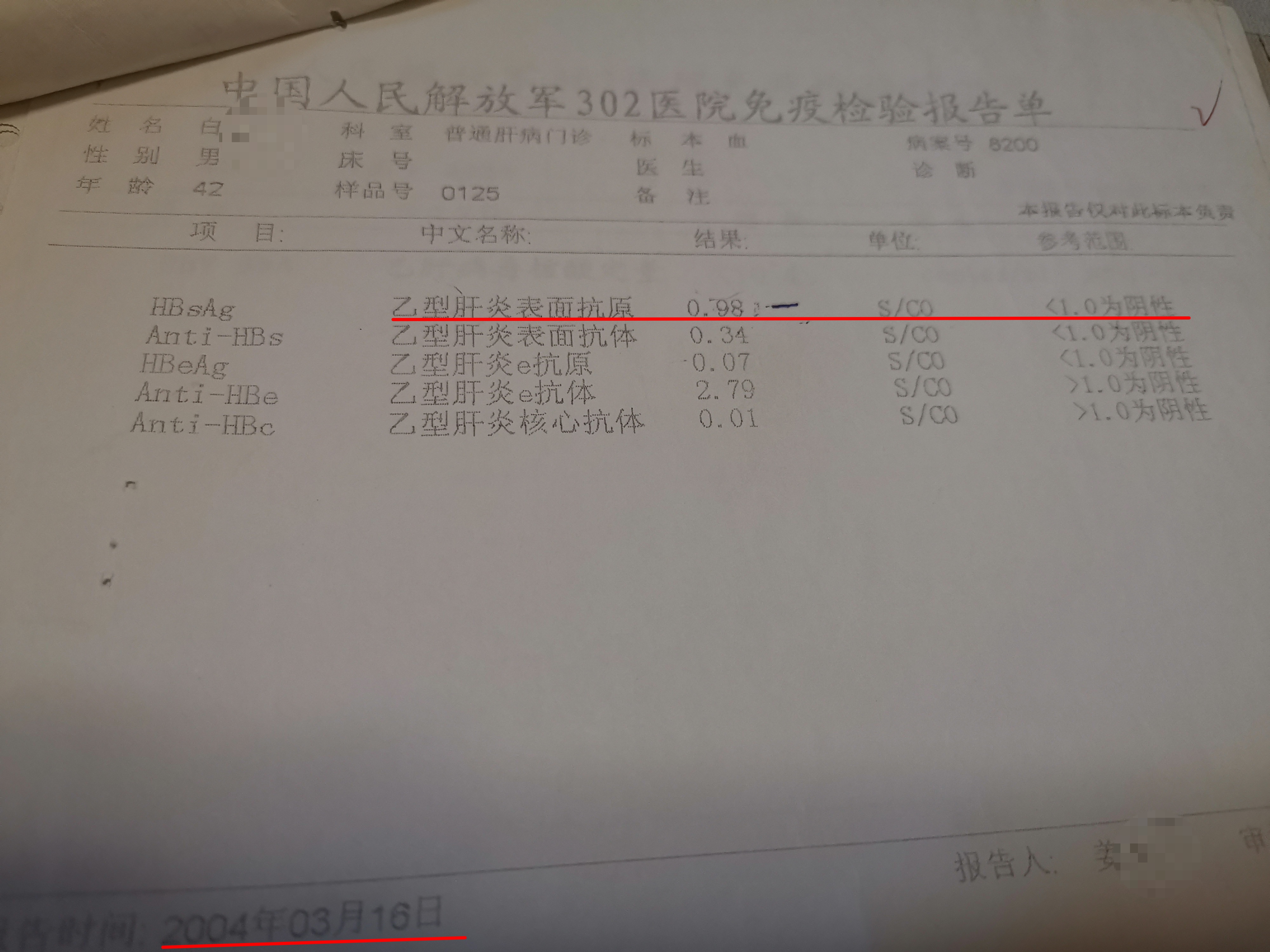 肝炎减轻肝负担,肝炎怕不怕