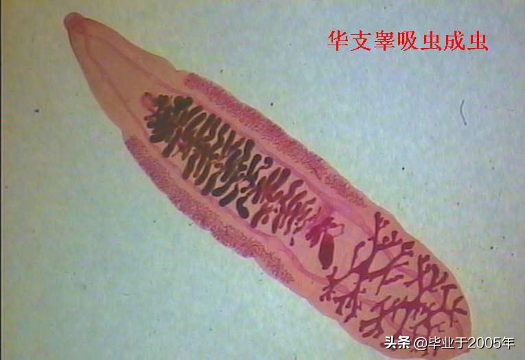 吃鱼虾的危害有哪些,吃鱼重金属超标对身体有什么伤害