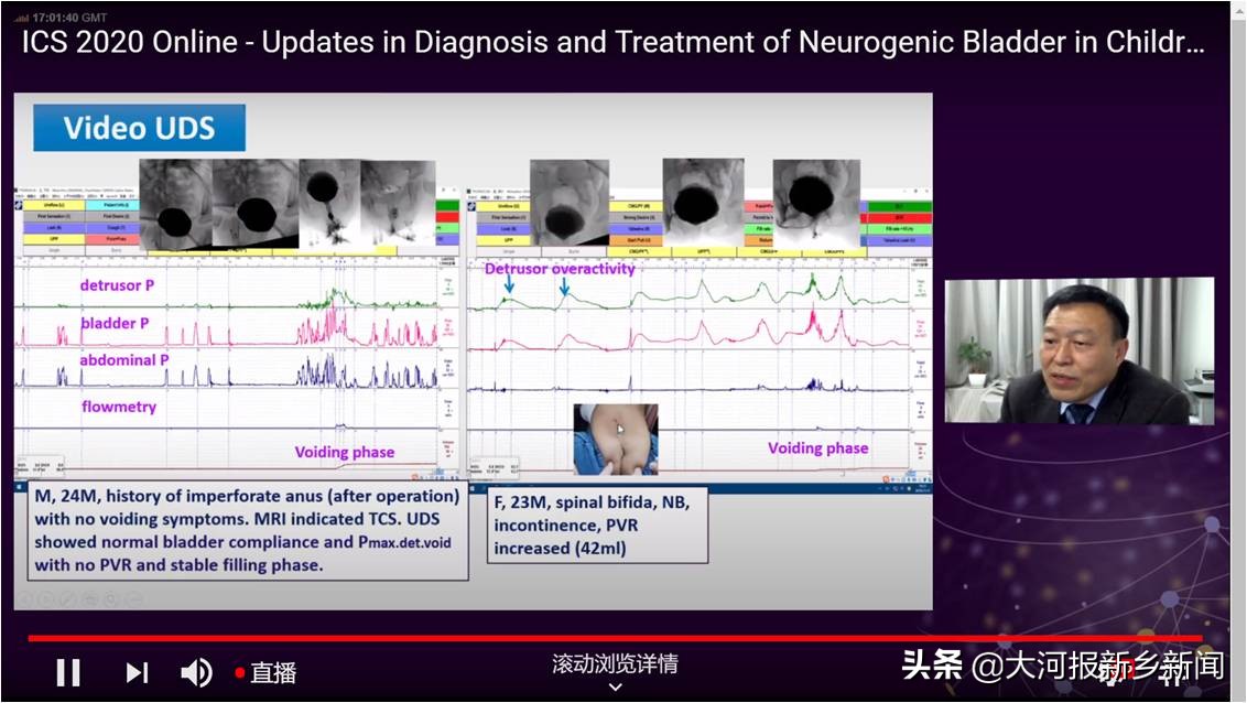 “河南尿控”团队叫响全球“顶天+立地”服务中外患者