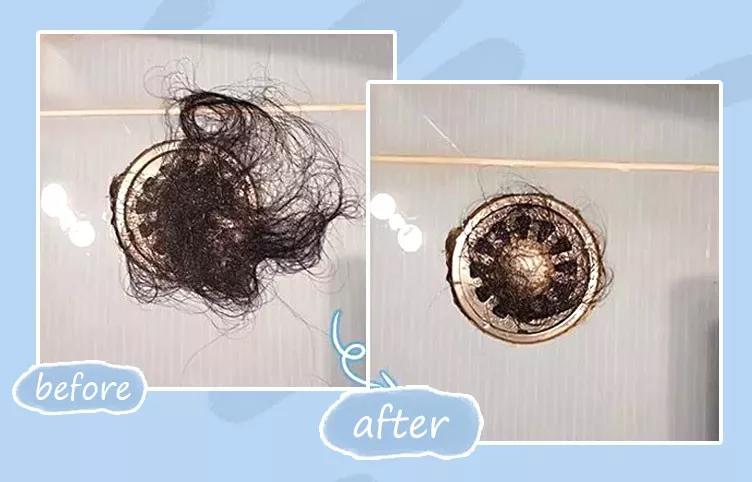 天天散着头发容易脱发吗,头发油了特别容易脱发