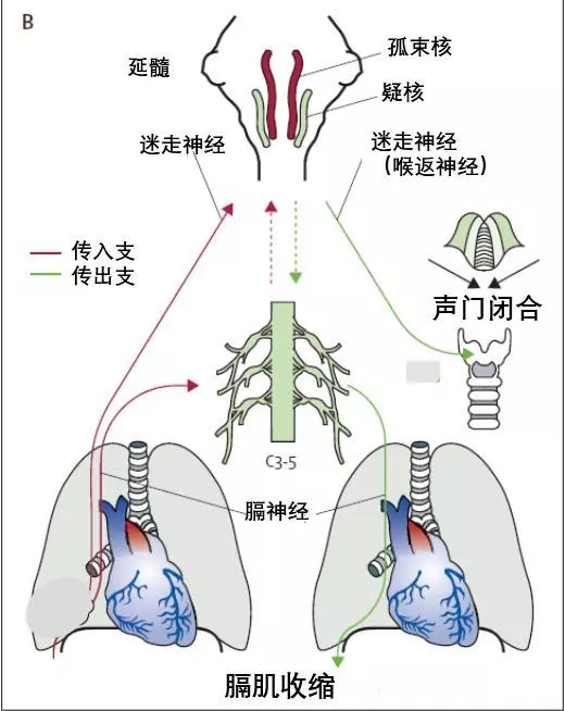 68岁老人打嗝4天，谁都没想到是心梗！医生说有这些症状也要当心