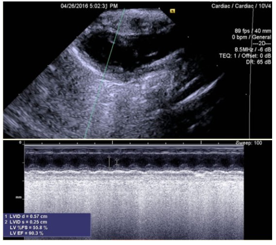北京协和医院治心脏好吗,体外心脏震波治疗系统
