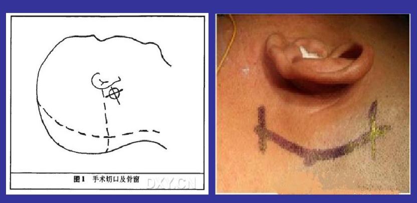 张医生治病救人后续,左眼皮一直跳咋回事好像痉挛