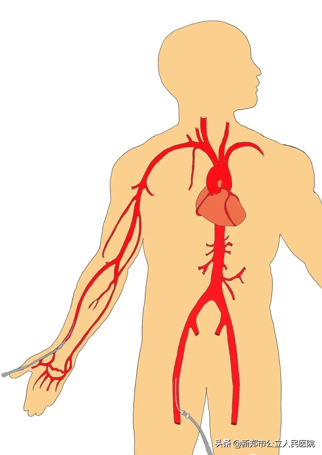冠脉造影科普宣讲,冠脉CT血管造影