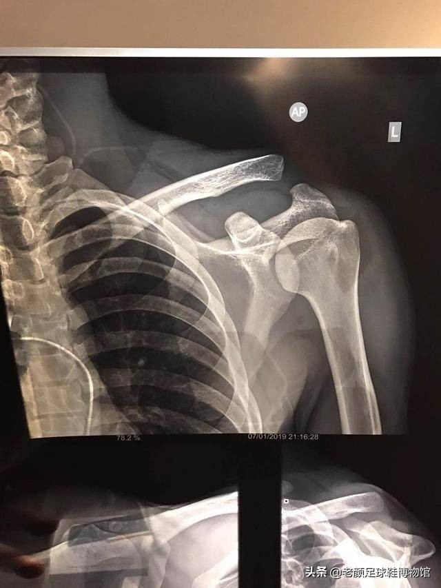 武磊肩伤面对两难选择，学萨拉赫竹篮打水，还是凯撒大帝名垂青史