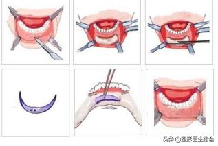 好看的下巴有哪些,好看的下巴