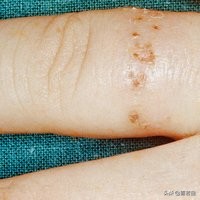 皮肤干燥脱皮10分钟清晨急救法,皮肤干燥尤其是秋冬会全身脱皮