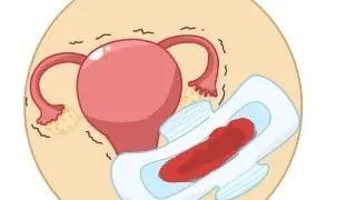 女生大姨妈量多正常还是量少正常,大姨妈来的量少怎么办需要治疗吗