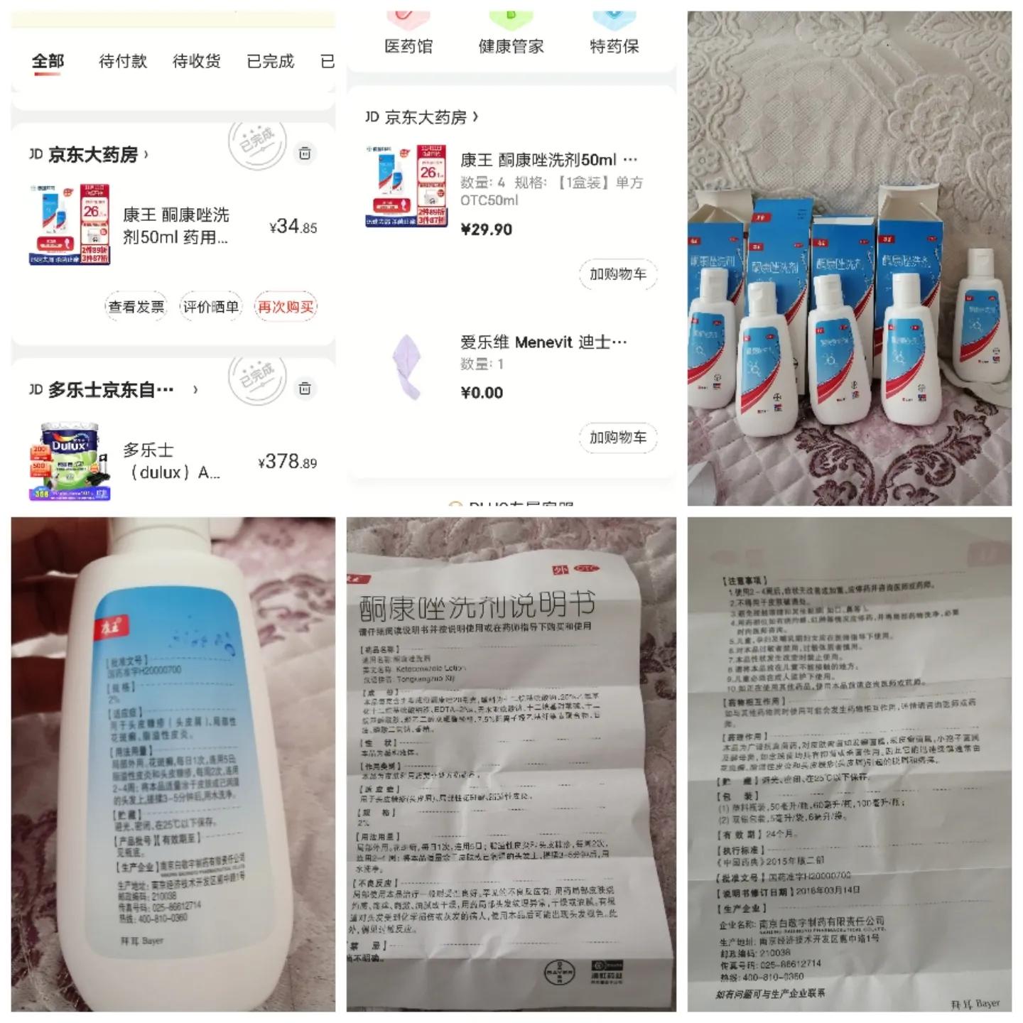 治好脱发的真实例子,我的脱发咋办