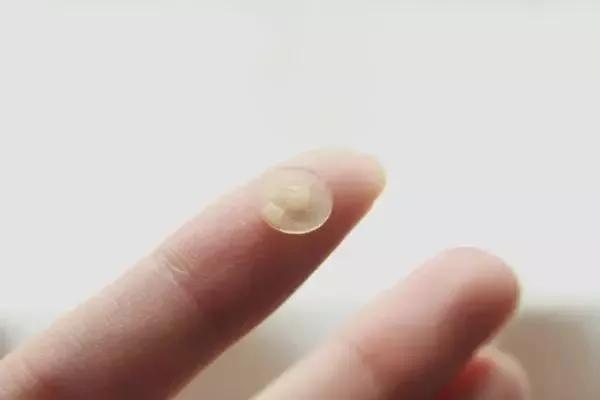 说说都如何治好痘痘的,一痘毁所有5个祛痘小技巧