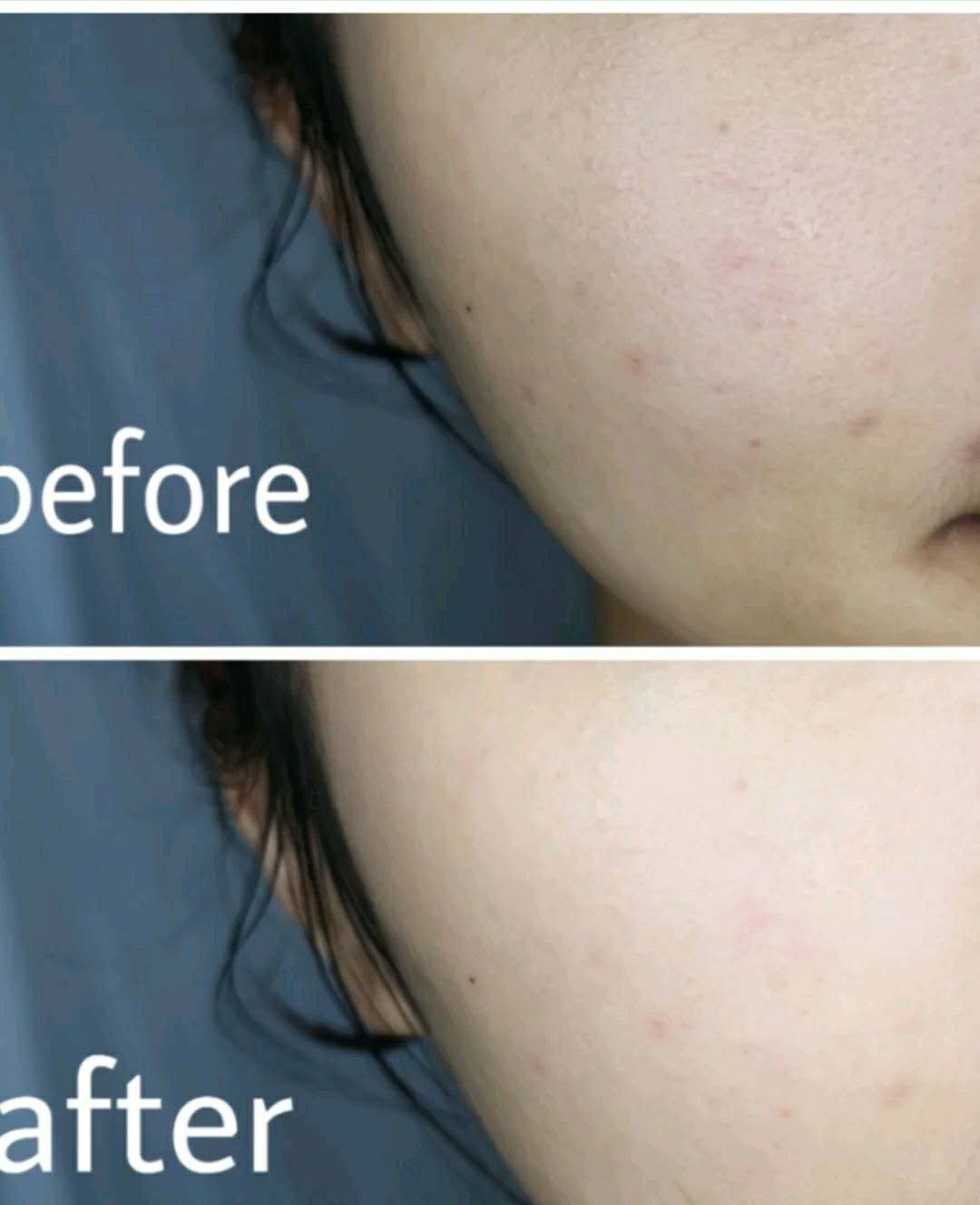 香奈儿哪款面膜好用推荐,兰蔻哪一款面膜好用一点女士