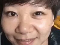 眼袋越来越严重怎么救,有眼袋显老十岁一招教你消除