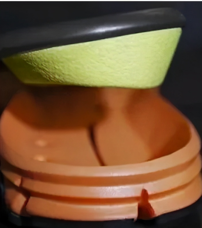 下肢不舒服查什么科,下肢不舒服做什么检查