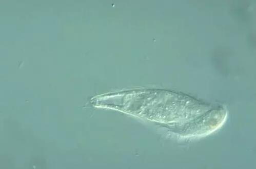 收藏!24种污水处理微生物菌相及指导意义,环保人必看(多图)
