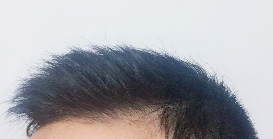 男士护发防脱大作战—我的头发养护四重奏