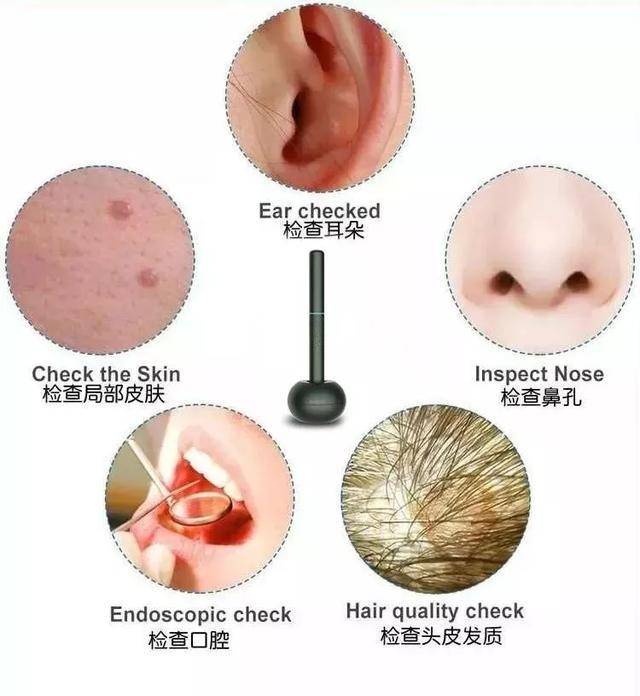 小米采耳,小米联合