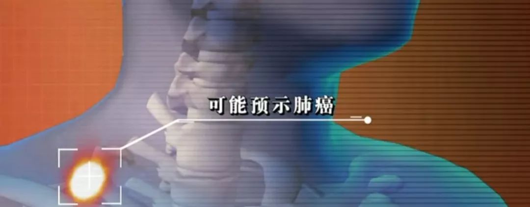 人体危险三角区的危害,身体三角区有哪些危险