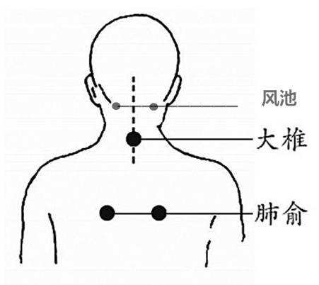 针灸酒糟鼻的放血疗法,针灸酒糟鼻的视频