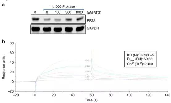 糖尿病肾病治疗新进展,糖尿病肾病最新研究