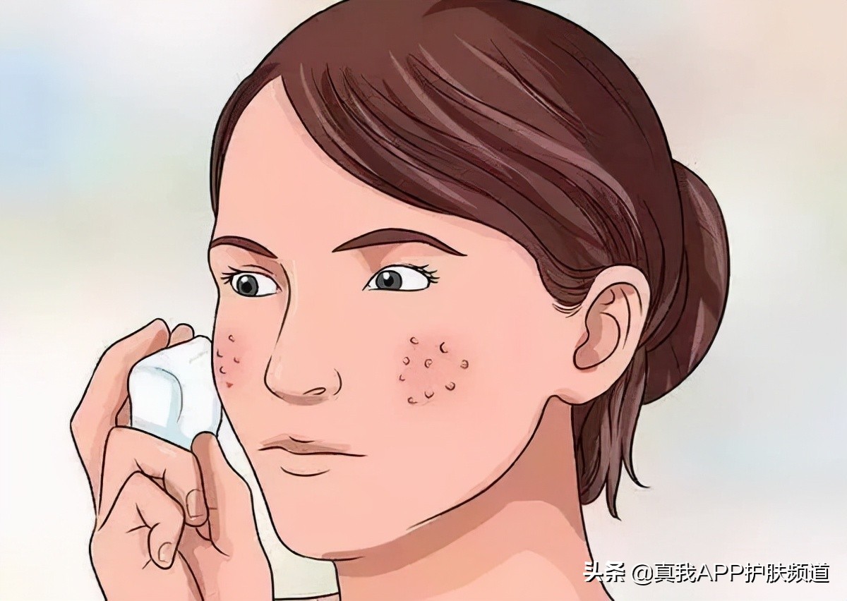 皮肤刷酸到底是什么意思,皮肤刷酸多久一次比较好