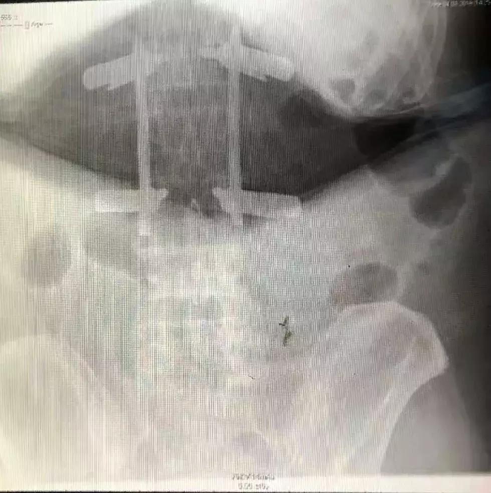 锦州发明专利,锦州实用新型专利