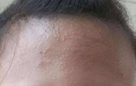 俏肌去黑头怎么样,俏肌护肤品怎么样