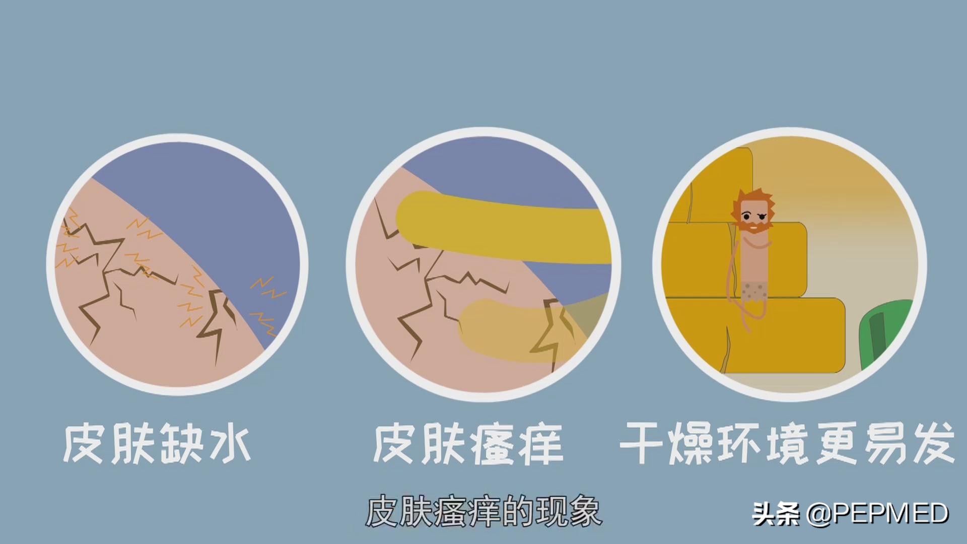 小腿奇痒一挠就破越挠越痒怎么治,皮肤痒一挠就发红怎么回事