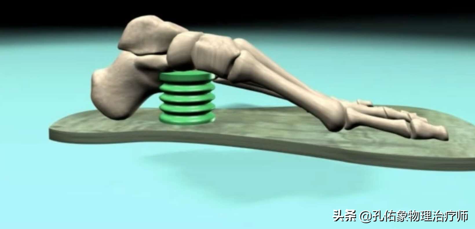 如何治疗足底筋膜炎缓解疼痛,足跟痛筋膜炎最佳的治疗办法