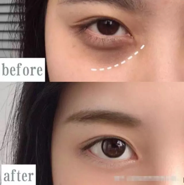 公认最好用的平价眼霜十大排行,最好用的十大平价眼霜排名