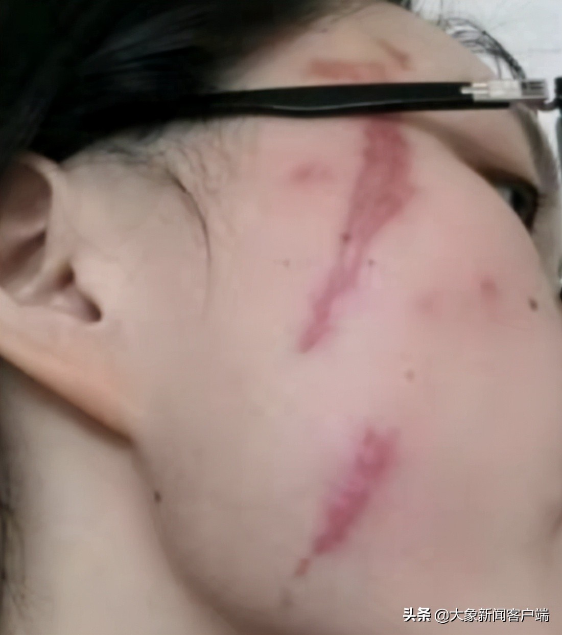 隐翅虫上热搜,一条小虫子上热搜