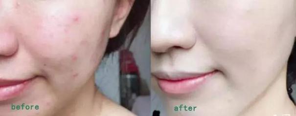 一支搞定遮瑕bb霜,一支bb霜