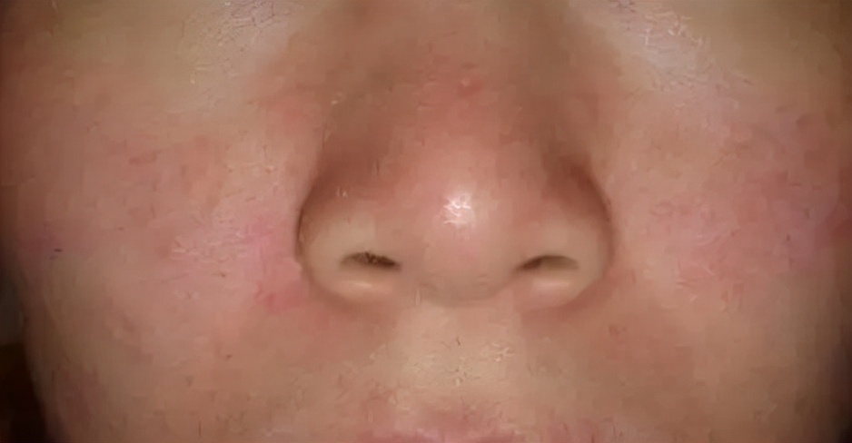 外用局部刺激药有哪些,外用药物对人体有什么危害