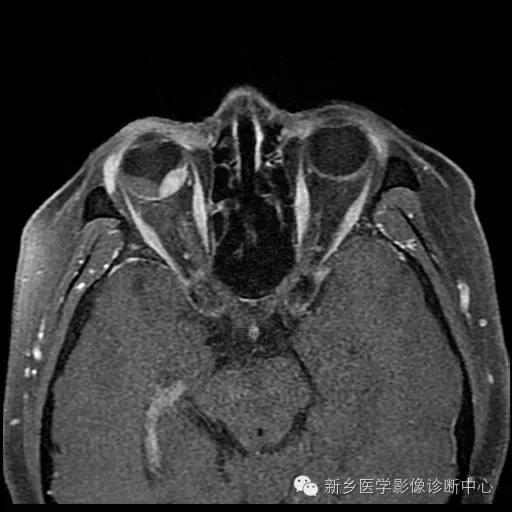 这些部位的黑色素瘤，您会诊断吗？