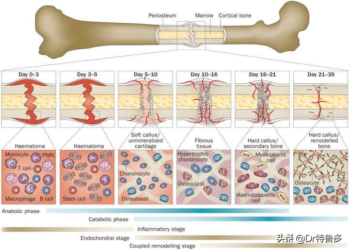 骨折久不愈合做冲击波有效吗,冲击波对骨不愈合有帮助吗