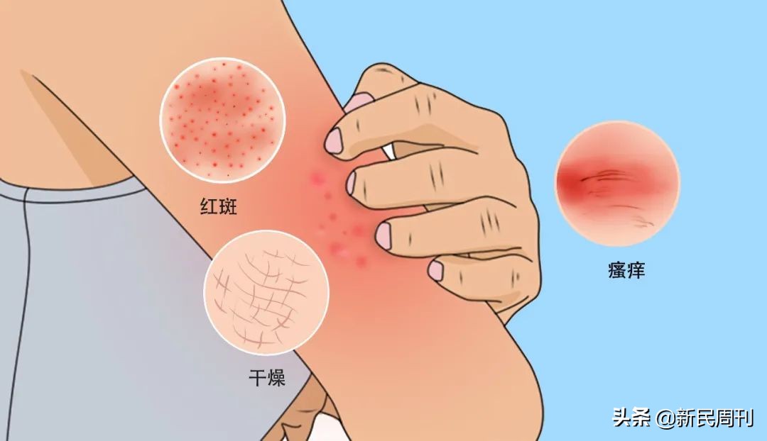 良医中医治好了吗,良医最新治疗方案