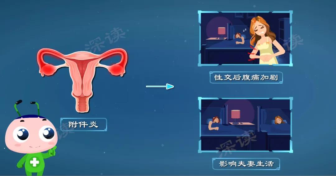 下腹持续隐痛？白带增多有异味？导致不孕的附件炎到底是啥样？