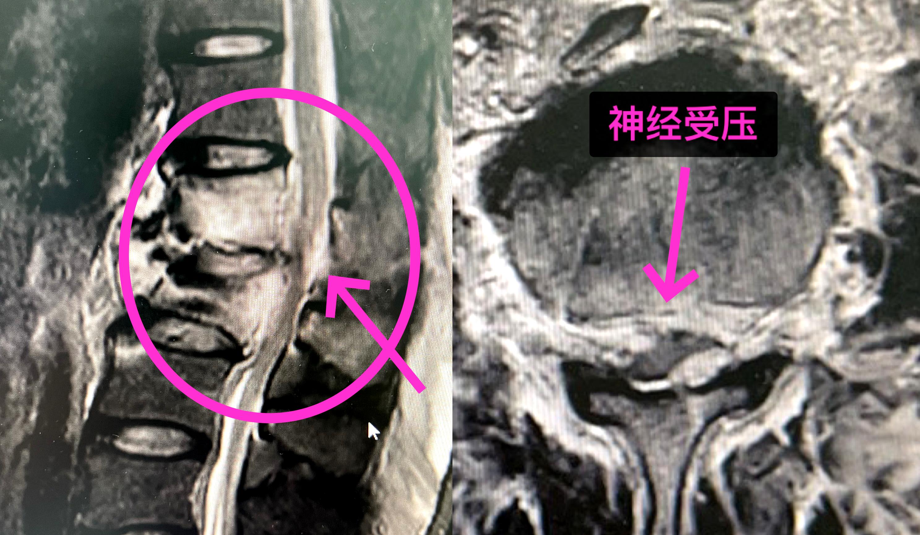 分秒必争救伤员,分秒必争的抢救