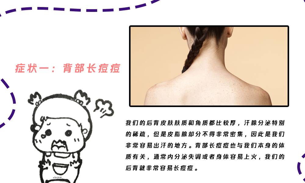 保养背部最好的方法就是开背,保养后背的十大方法