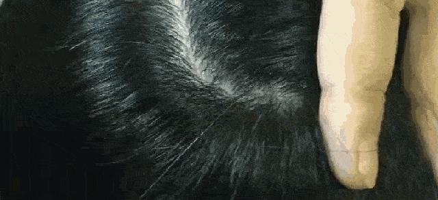 天天散着头发容易脱发吗,头发油了特别容易脱发