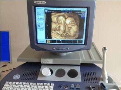 四维彩超大揭秘：怀孕了，你做四维彩超检查了吗？