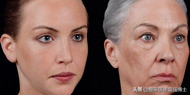 面部除皱用什么方法效果最好,目前面部除皱最安全有效的方法